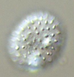  urediniospore of  U. monsterae 
